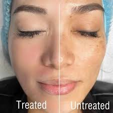 BB Glow Face Treatment